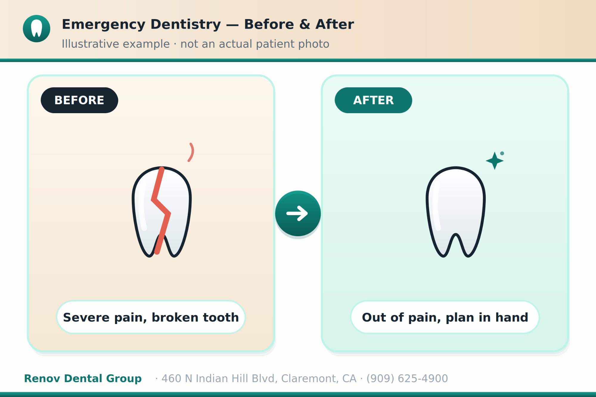 emergency dentist 03 before after illustration