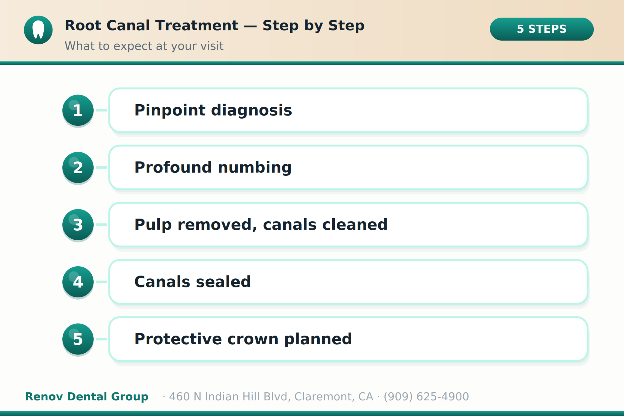 root canal 02 procedure steps