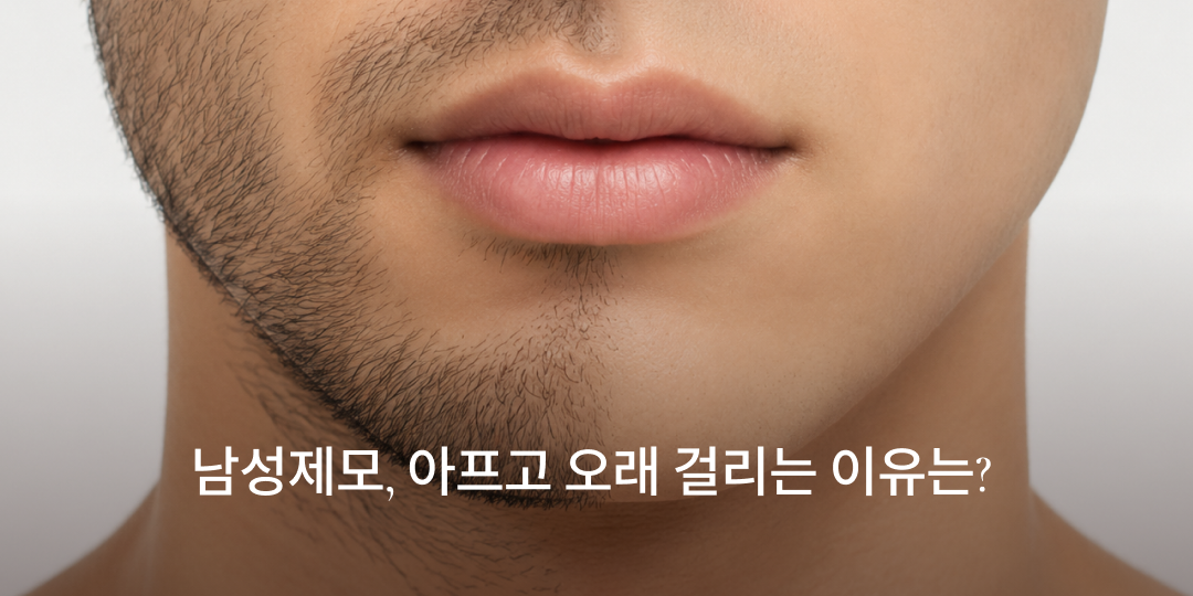 Men's laser hair removal: why it hurts and takes longer
