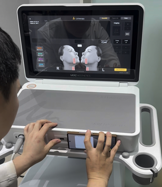 H1: Ultherapy Prime Authenticity Check in Gangnam, Seoul: How to Confirm Your Treatment Is Genuine (2026 Guide)
