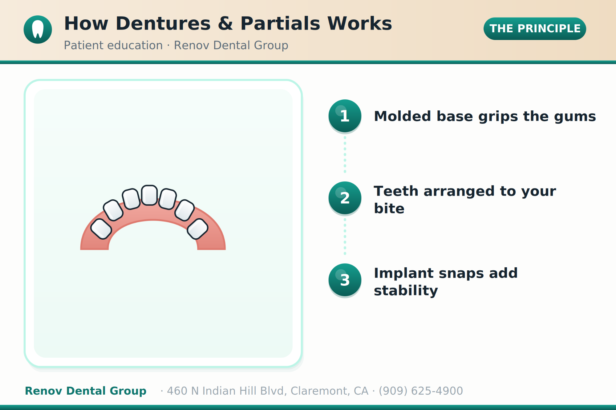 dentures 01 how it works