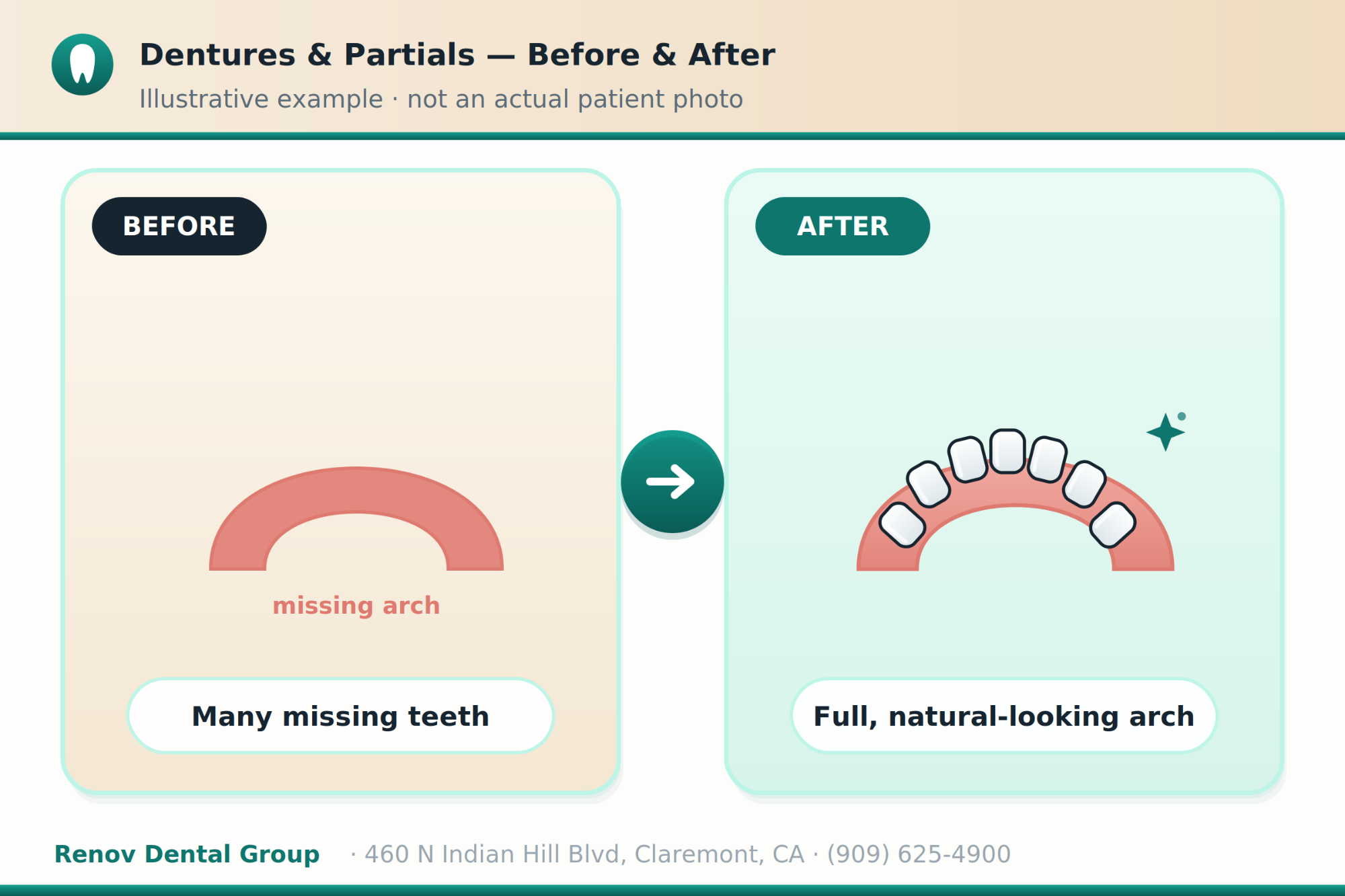 dentures 03 before after illustration